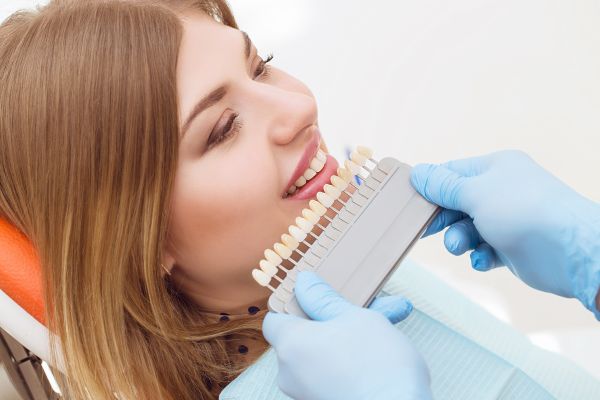 Do Dental Veneers Have Any Side Effects?