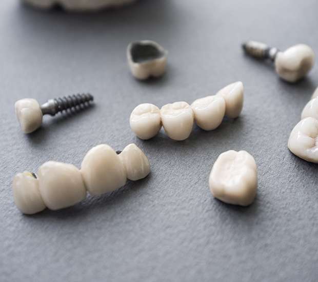 Williamsburg The Difference Between Dental Implants and Mini Dental Implants